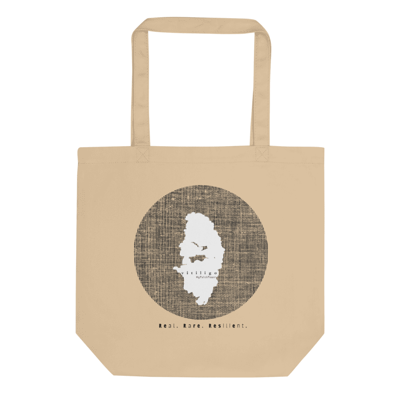 Personalised Vitiligo Tote Bag