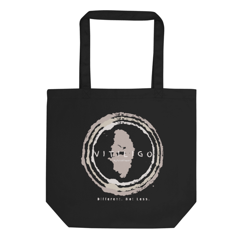 Personalised Vitiligo Tote Bag