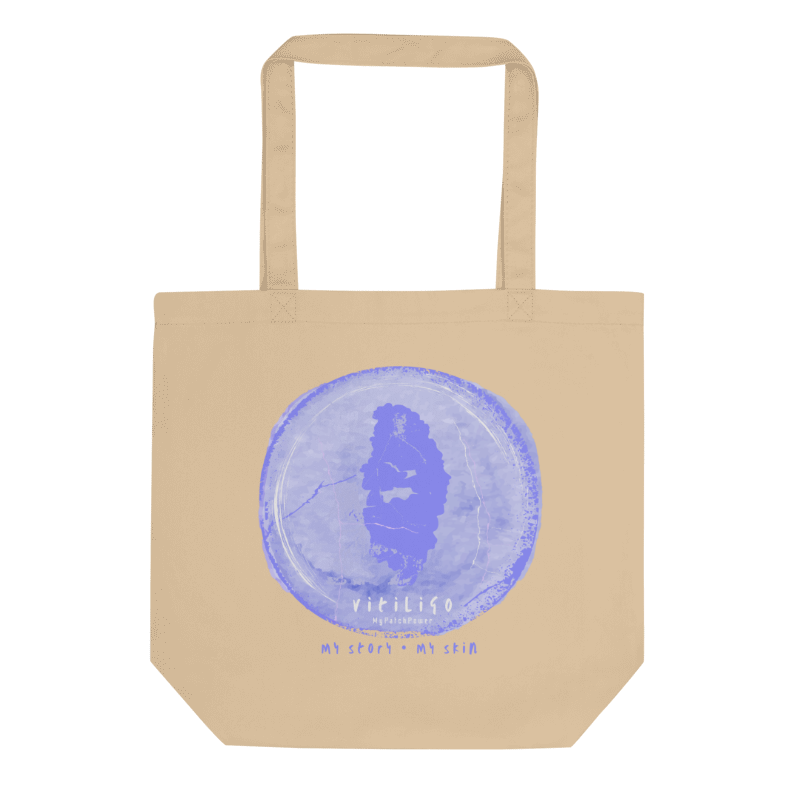 Personalised Vitiligo Tote Bag