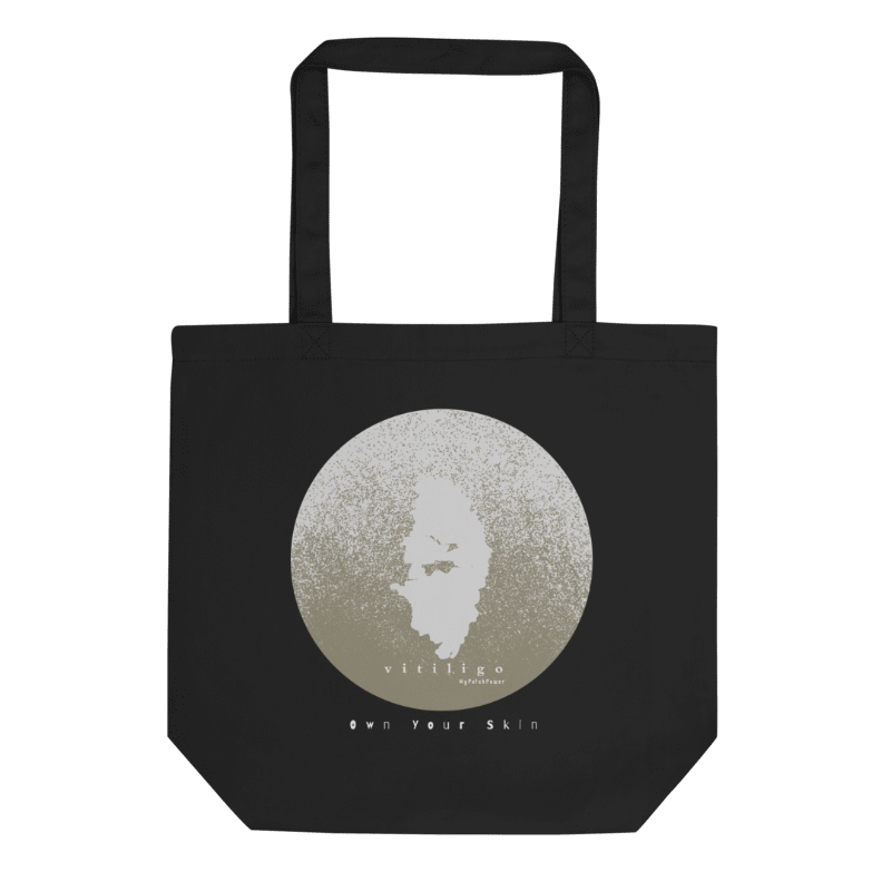 Personalised Vitiligo Tote Bag