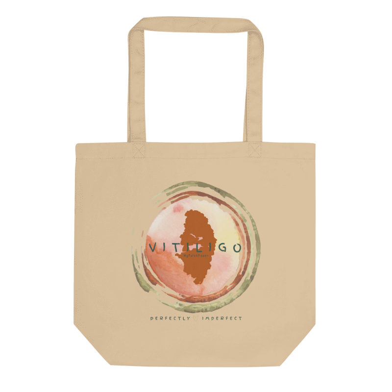 Personalised Vitiligo Tote Bag