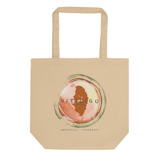 Personalised Vitiligo Tote Bag