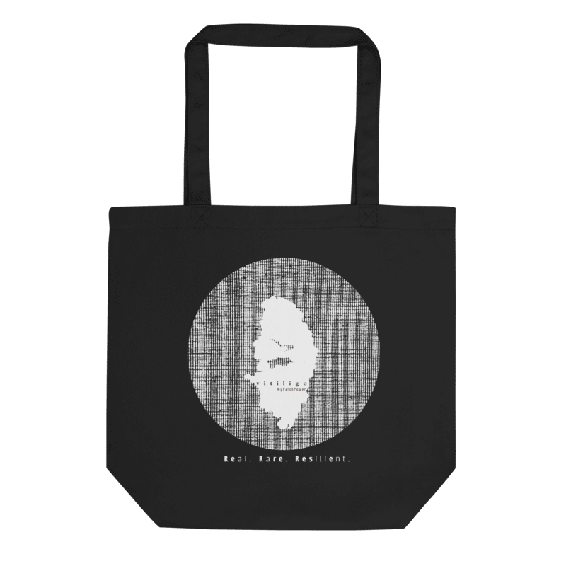 Personalised Vitiligo Tote Bag